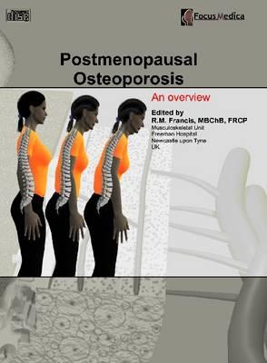 Postmenopausal Osteoporosis: An Overview