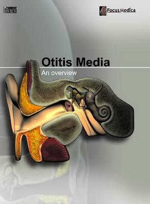 Otitis Media: An Overview