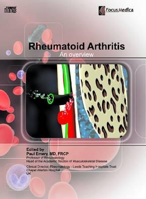 Rheumatoid Arthritis: An Overview