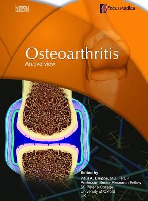 Osteoarthritis: An Overview