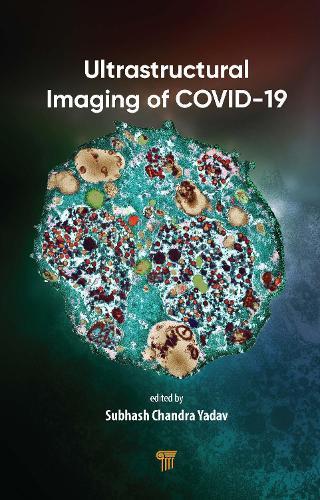 Ultrastructural Imaging of COVID-19