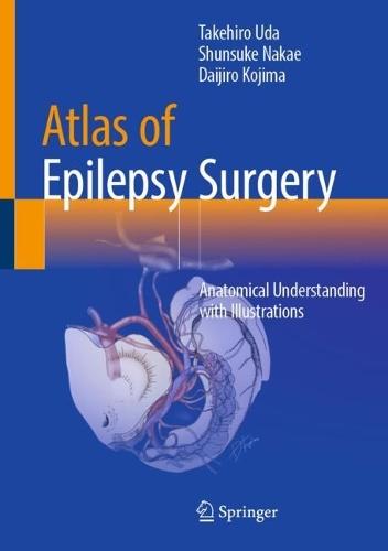 Atlas of Epilepsy Surgery: Anatomical Understanding with Illustrations