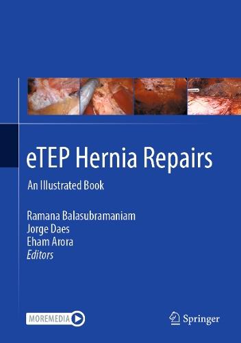eTEP Hernia Repairs: An Illustrated Book