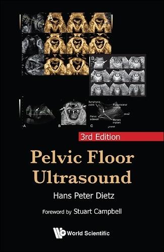 Pelvic Floor Ultrasound (3rd Edition)