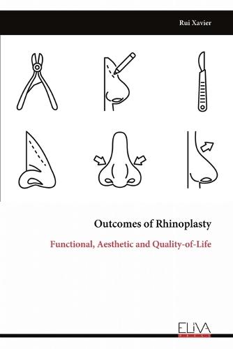 Outcomes of Rhinoplasty: Functional, Aesthetic and Quality-of-Life