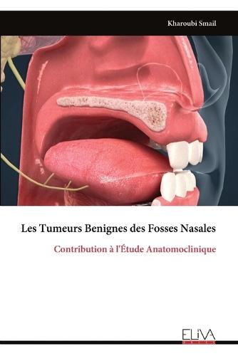 Les Tumeurs Benignes des Fosses Nasales: Contribution à l'Étude Anatomoclinique