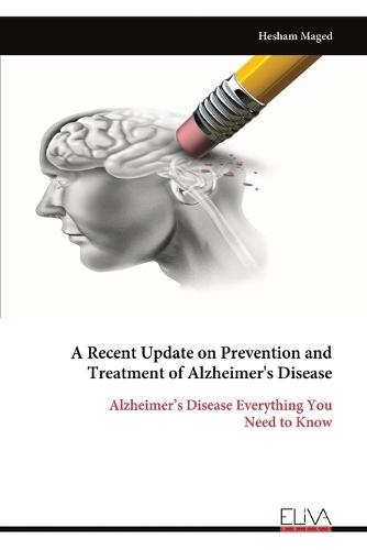 A Recent Update on Prevention and Treatment of Alzheimer's Disease
