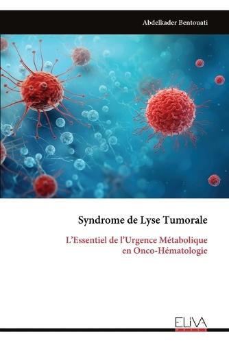 Syndrome de Lyse Tumorale: L'Essentiel de l'Urgence Métabolique en Onco-Hématologie