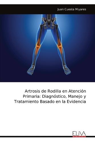 Artrosis de Rodilla en Atención Primaria: Diagnóstico, Manejo y Tratamiento Basado en la Evidencia