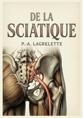 De la sciatique: Une analyse historique, sémiologique et thérapeutique de la sciatique par P. A. Lagrelette, offrant un aperçu détaillé des causes, symptômes et traitements de cette affection.