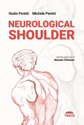 Neurological Shoulder