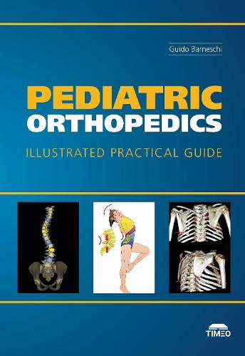 Pediatric Orthopedics: Illustrated Practical Guide