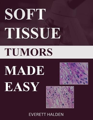 Soft Tissue Tumors Made Easy: A High-Yield Guide to Differential Diagnosis for Medical Students and Pathology Residents