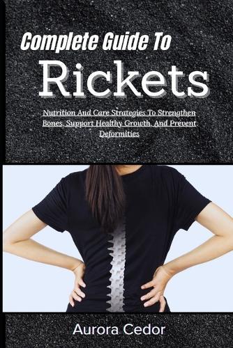 Complete Guide To Rickets: Nutrition And Care Strategies To Strengthen Bones, Support Healthy Growth, And Prevent Deformities