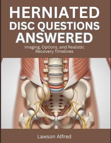 Herniated Disc Questions Answered: Imaging, Options, and Realistic Recovery Timelines