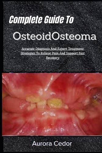 Complete Guide To OsteoidOsteoma: Accurate Diagnosis And Expert Treatment Strategies To Relieve Pain And Support Fast Recovery