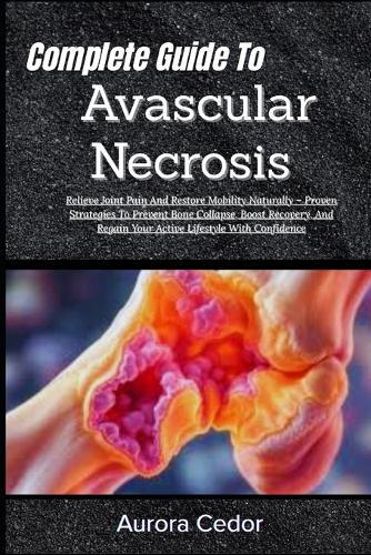 Complete Guide To Avascular Necrosis: Relieve Joint Pain And Restore Mobility Naturally - Proven Strategies To Prevent Bone Collapse, Boost Recovery, And Regain Your Active Lifestyle With Confidence