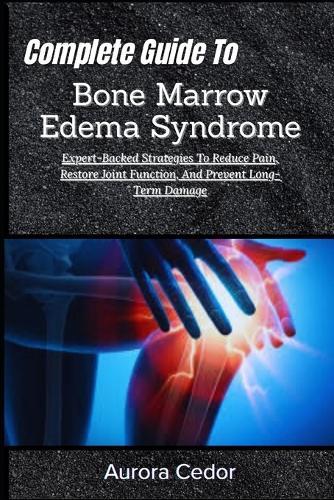 Complete Guide To Bone Marrow Edema Syndrome: Expert-Backed Strategies To Reduce Pain, Restore Joint Function, And Prevent Long-Term Damage