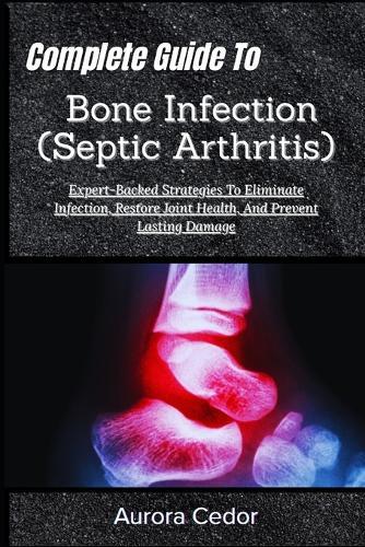 Complete Guide To Bone Infection (Septic Arthritis): Expert-Backed Strategies To Eliminate Infection, Restore Joint Health, And Prevent Lasting Damage