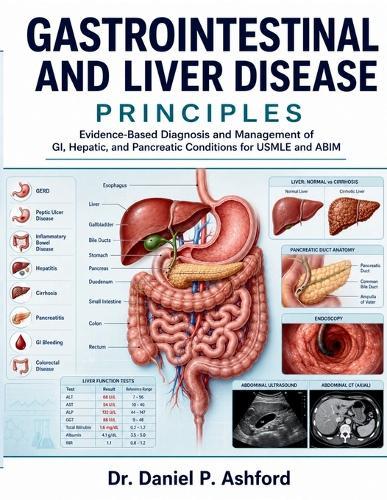 Gastrointestinal And Liver Disease Principles: Evidence-Based Diagnosis and Management of GI, Hepatic, and Pancreatic Conditions for USMLE and ABIM