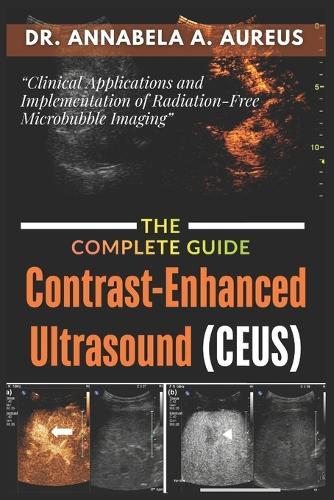 Contrast-Enhanced Ultrasound (CEUS): The Complete Guide: Clinical Applications and Implementation of Radiation-Free Microbubble Imaging