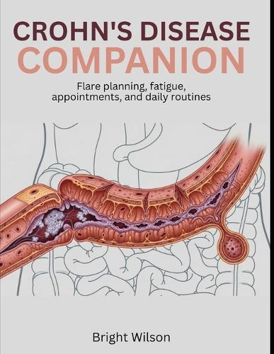 Crohn's Disease Companion: Flare planning, fatigue, appointments, and daily routines