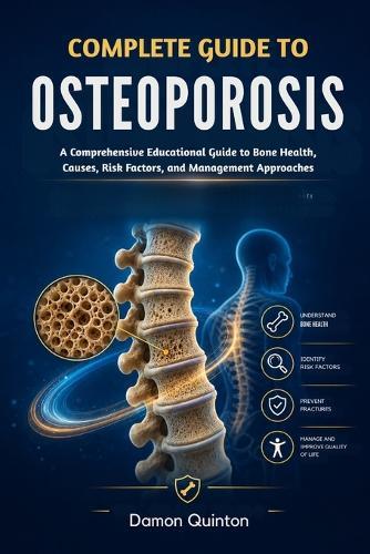 Complete Guide To Osteoporosis: A Comprehensive Educational Guide to Bone Health, Causes, Risk Factors, and Management Approaches