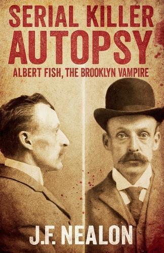 Serial Killer Autopsy: Albert Fish, The Brooklyn Vampire