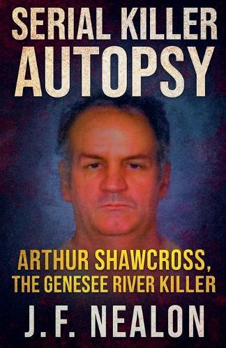 Serial Killer Autopsy: Arthur Shawcross