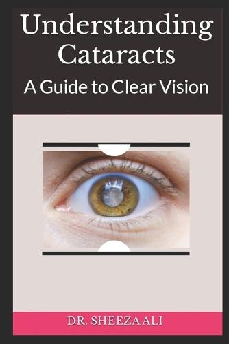 Understanding Cataracts: A Guide to Clear Vision