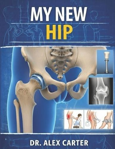 My New Hip: The Complete Guide to Hip Replacement Surgery, Recovery, Rehab, Pain Relief, Exercises, and Regaining Mobility