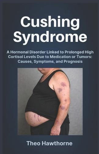 Cushing Syndrome: A Hormonal Disorder Linked to Prolonged High Cortisol Levels Due to Medication or Tumors: Causes, Symptoms, and Prognosis