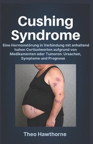 Cushing Syndrome: Eine Hormonstörung in Verbindung mit anhaltend hohen Cortisolwerten aufgrund von Medikamenten oder Tumoren: Ursachen, Symptome und Prognose