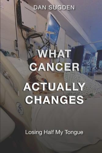 What Cancer Actually Changes: Losing Half My Tongue