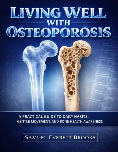 Living Well With Osteoporosis: A Practical Guide to Daily Habits, Gentle Movement, and Bone Health Awareness