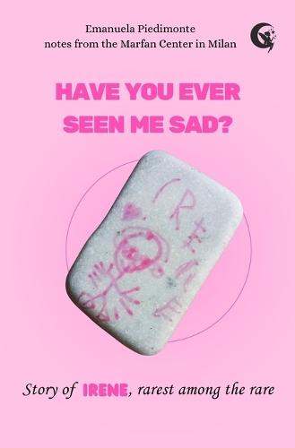 Have you ever seen me sad? Story of Irene, rarest among the rare