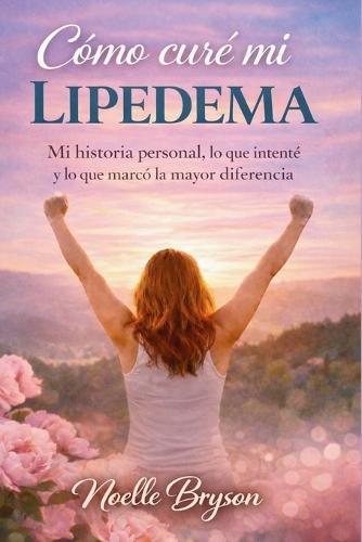 Cómo curé mi lipedema: Mi historia personal, lo que intenté y lo que marcó la mayor diferencia