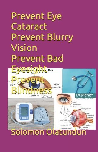 Prevent Eye Cataract Prevent Blurry Vision Prevent Bad Eyesight Prevent Blindness