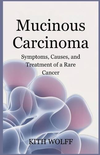Mucinous Carcinoma: Symptoms, Causes, and Treatment of a Rare Cancer