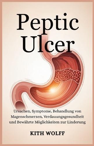 Peptic Ulcer: Ursachen, Symptome, Behandlung von Magenschmerzen, Verdauungsgesundheit und bewährte Möglichkeiten zur Linderung