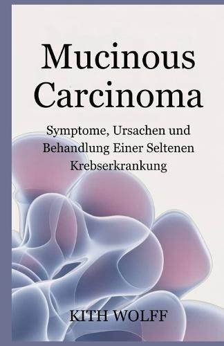 Mucinous Carcinoma: Symptome, Ursachen und Behandlung einer seltenen Krebserkrankung