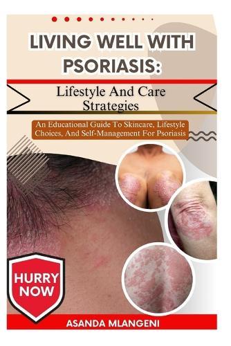 Living Well With Psoriasis: Lifestyle And Care Strategies: An Educational Guide To Skincare, Lifestyle Choices, And Self-Management For Psoriasis