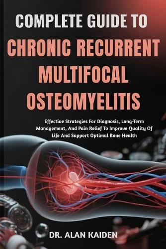 Complete Guide to Chronic Recurrent Multifocal Osteomyelitis: Effective Strategies For Diagnosis, Long-Term Management, And Pain Relief To Improve Quality Of Life And Support Optimal Bone Health