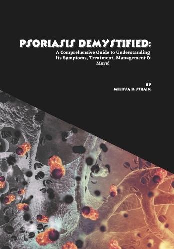 Psoriasis Demystified: A Comprehensive Guide to Understanding Its Symptoms, Treatment, Management & More!