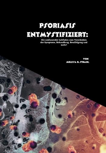 Psoriasis entmystifiziert: Ein umfassender Leitfaden zum Verständnis der Symptome, Behandlung, Bewältigung und mehr!