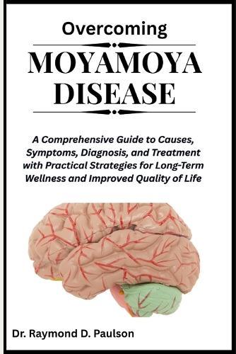 Overcoming Moyamoya Disease: A Comprehensive Guide to Causes, Symptoms, Diagnosis, and Treatment with Practical Strategies for Long-Term Wellness and Improved Quality of Life