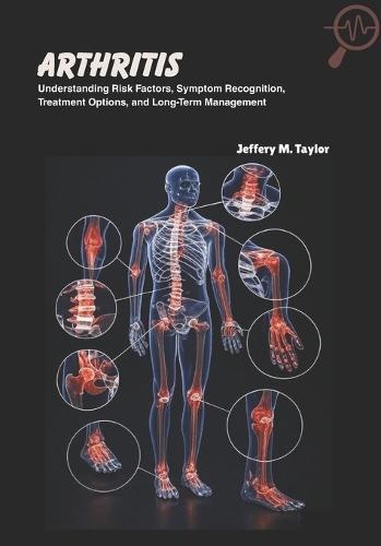 Arthritis: Understanding Risk Factors, Symptom Recognition, Treatment Options, and Long-Term Management