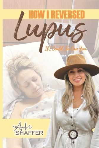 How I Reversed Lupus: If I Could, So Can You