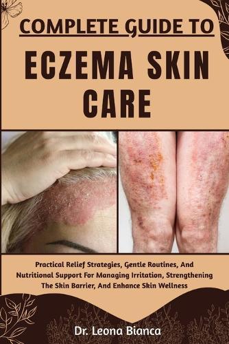 Complete Guide to Eczema Skin Care: Practical Relief Strategies, Gentle Routines, And Nutritional Support For Managing Irritation, Strengthening The Skin Barrier, And Enhance Skin Wellness