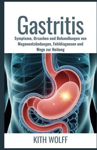 Gastritis: Symptome, Ursachen und Behandlungen von Magenentzündungen, Fehldiagnosen und Wege zur Heilung
